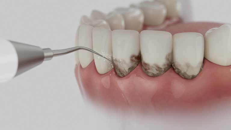 Reliable Teeth Cleaning And Checkup contractor in Pulaski County County, GA by Dentist Open Now